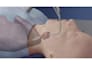 do 3d medical animation cervical disc replacement spine surgery anatomy video